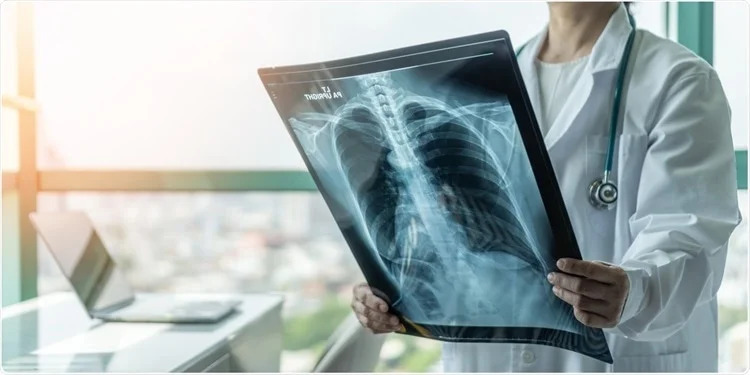 COVID-19 Linked to New Lung Disease with Concerning Symptoms. Credit | Shutterstock